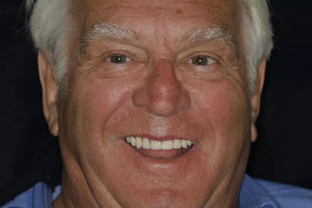 Geoffrey's Story, TDC Implant Centres