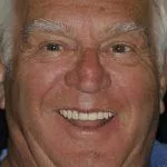 Geoffrey's Story, TDC Implant Centres