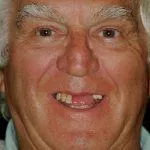Geoffrey's Story, TDC Implant Centres