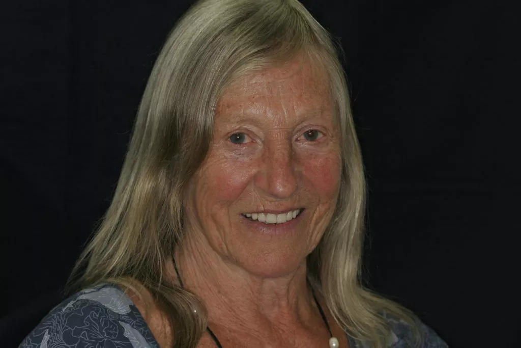 Pamela's Story, TDC Implant Centres