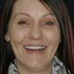 Mary's Story, TDC Implant Centres