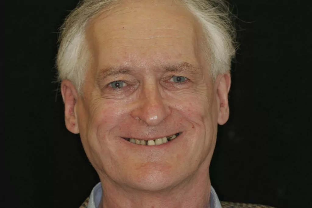 John's Story, TDC Implant Centres