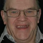 Henry's Story, TDC Implant Centres