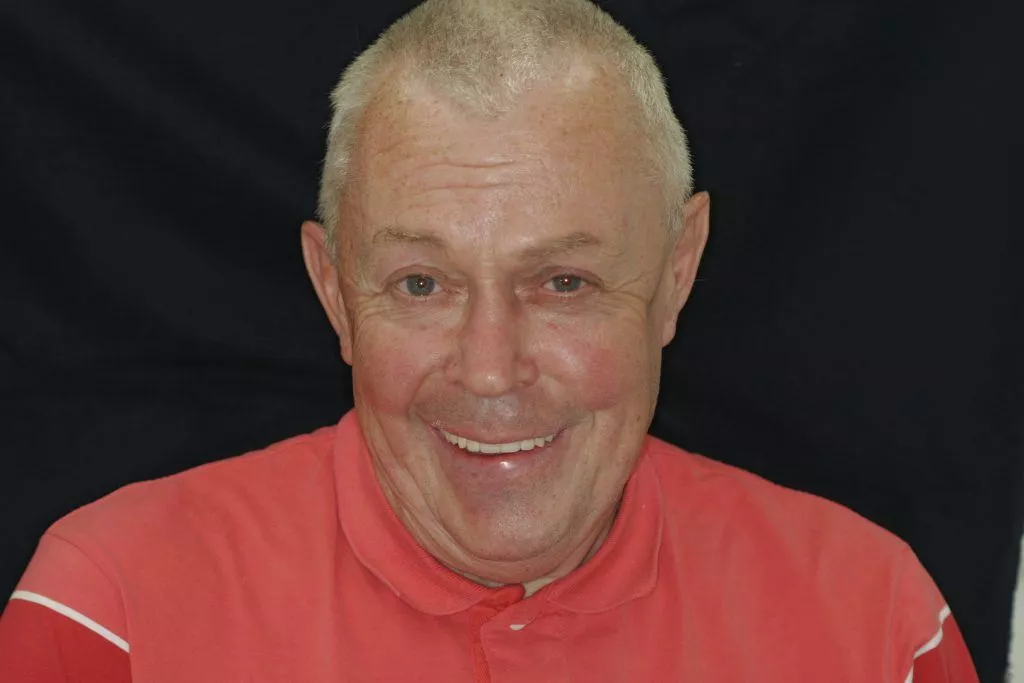 Dennis's Story, TDC Implant Centres