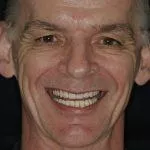Gordon's Story, TDC Implant Centres