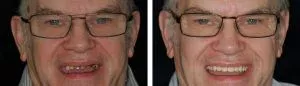 Henry photo-transforms-case14
