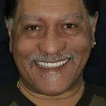 Keith's Story, TDC Implant Centres