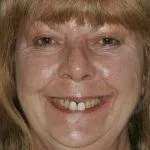 Jaquelin's Story, TDC Implant Centres