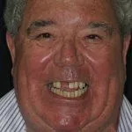 Tony's Story, TDC Implant Centres