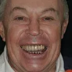 Dennis's Story, TDC Implant Centres