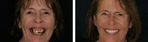shannon photo-transforms-case16