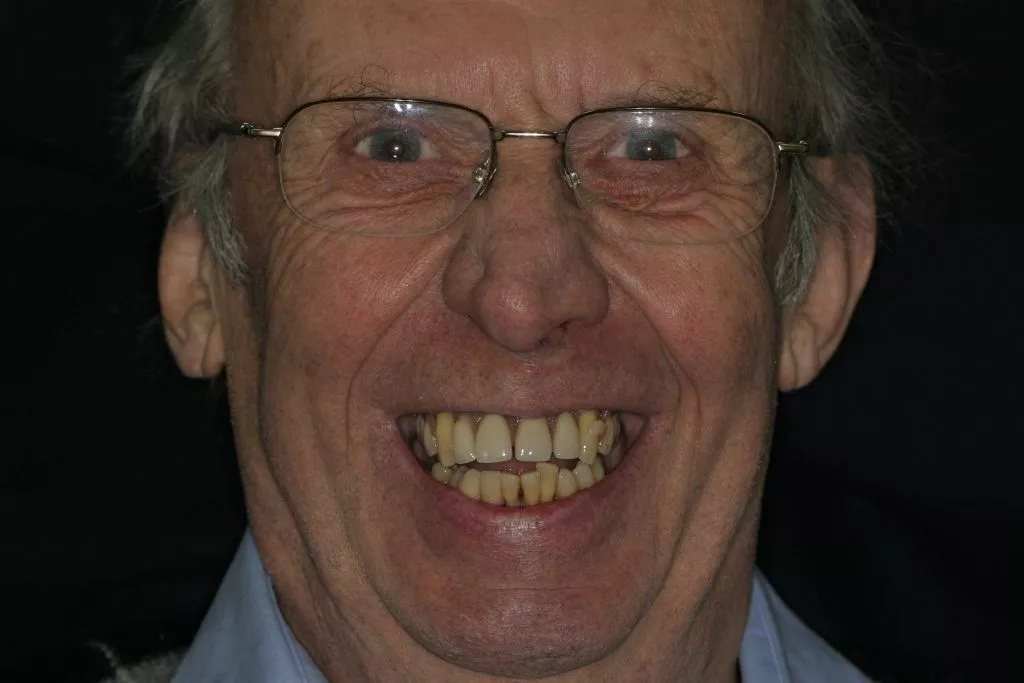 Wojtowicz 's Story, TDC Implant Centres