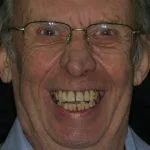 Wojtowicz 's Story, TDC Implant Centres