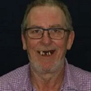 loach-john-pre-op-305-x-305