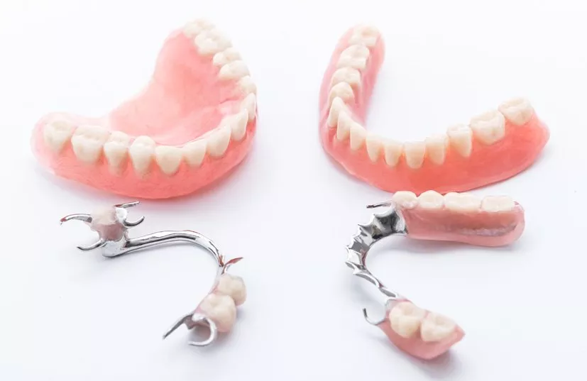 Dentures, or false teeth, are artiﬁcial teeth that ﬁll the gaps left by missing teeth.